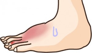 擦り傷がグジュグジュで化膿しているみたい。プールに入っても大丈夫？