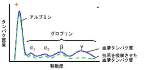 貧血,むく,み爪,変形,スプーン爪,二枚爪