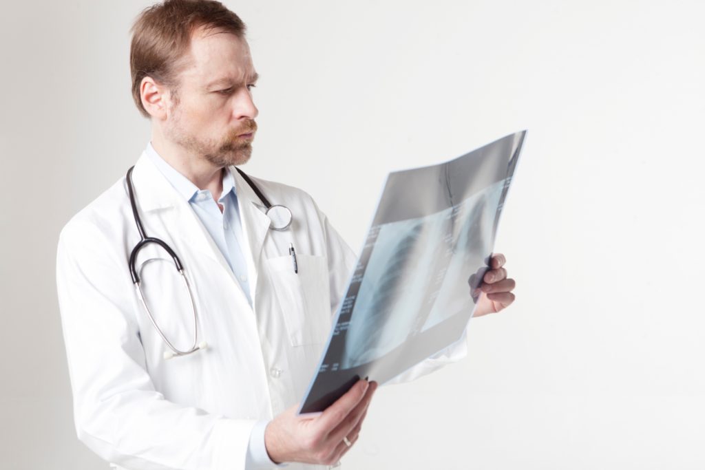 イボ　液体窒素