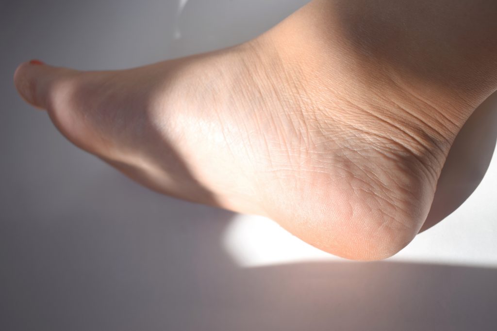 ウイルス性イボ　原因