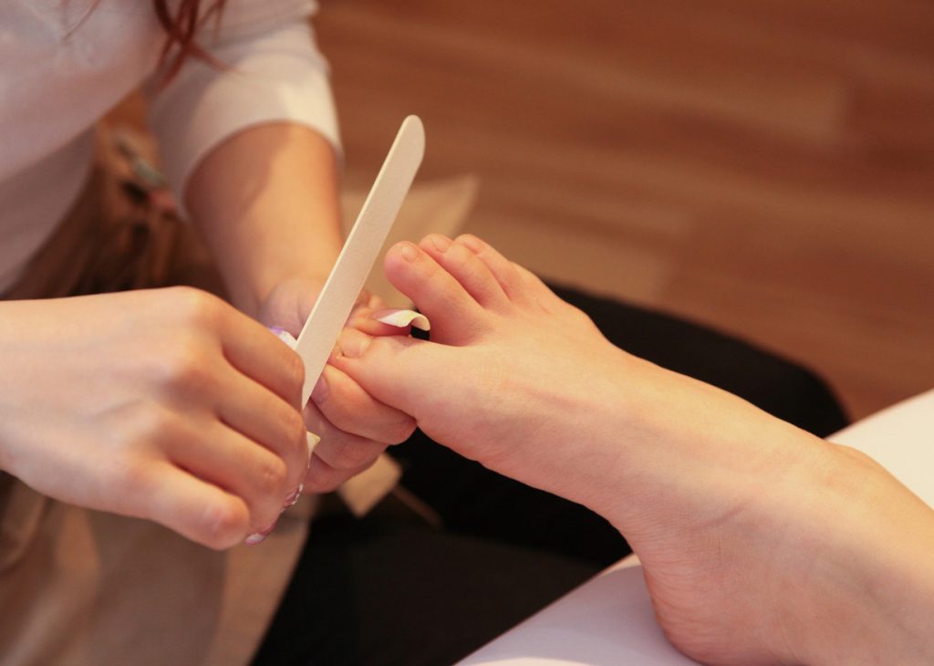 巻き爪　矯正　自分で