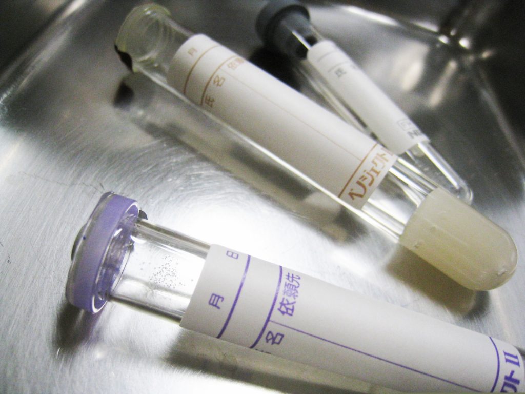 血液検査　wbc　白血球