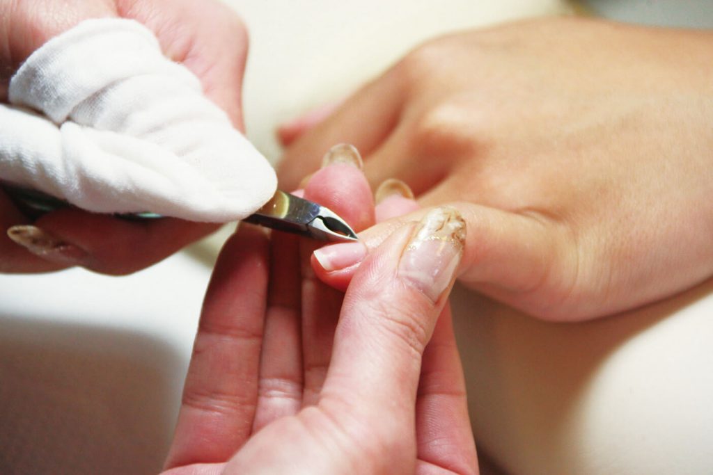 爪 白い部分ない